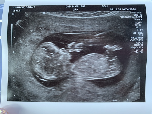 Nub/GOD theory - boy or girl?!