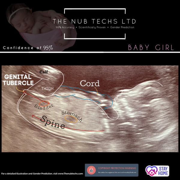 Late October babies - Thread 2