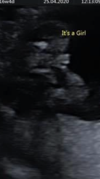 Definitely a boy?