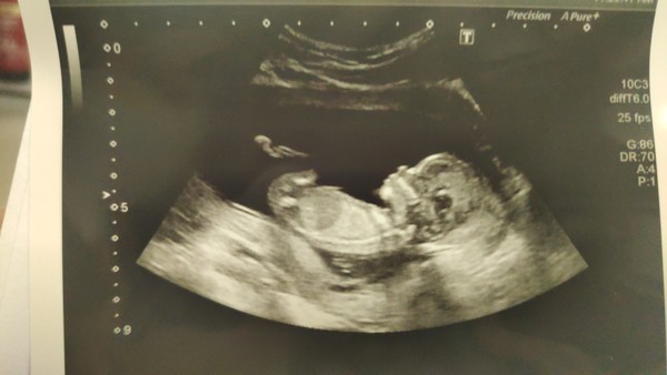 November 2020 Babies - Thread 5
