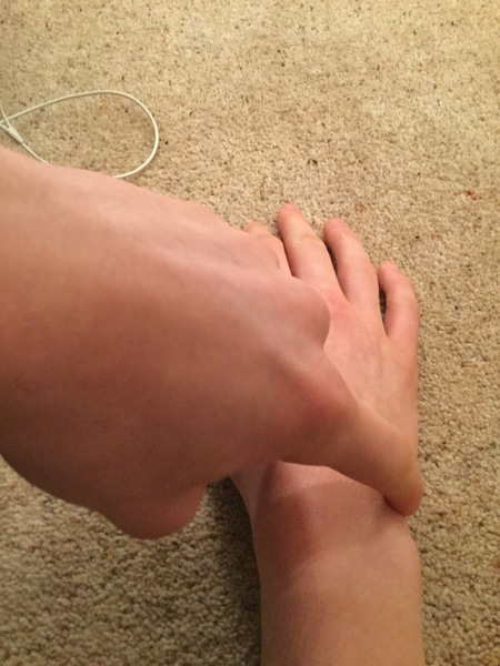 No physios working. Son’s sprained wrist won’t heal -any advice?