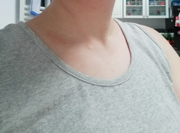 Weird lump...
