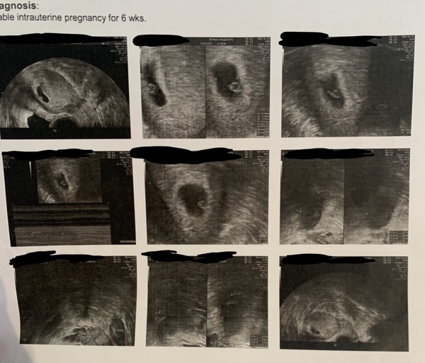 December 2020 babies thread #2