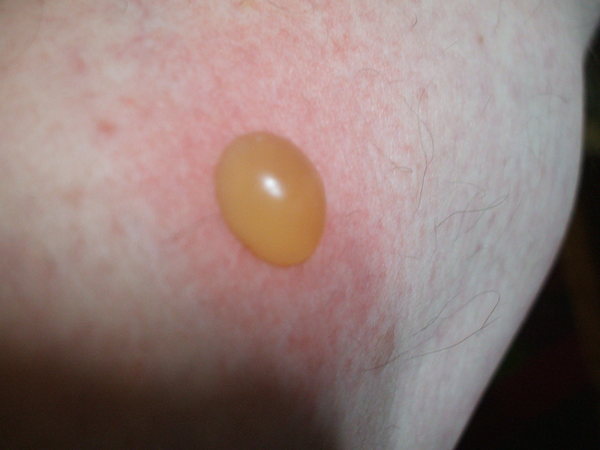 KLAXON..................I have a Bite............