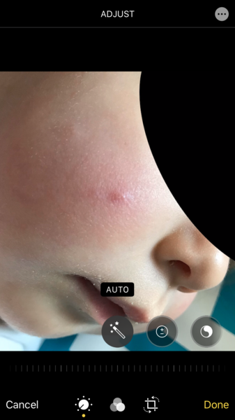Any idea about this spot on my toddlers face?