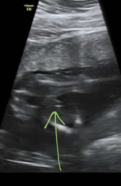 Boy or Girl? (Willy or UC)
