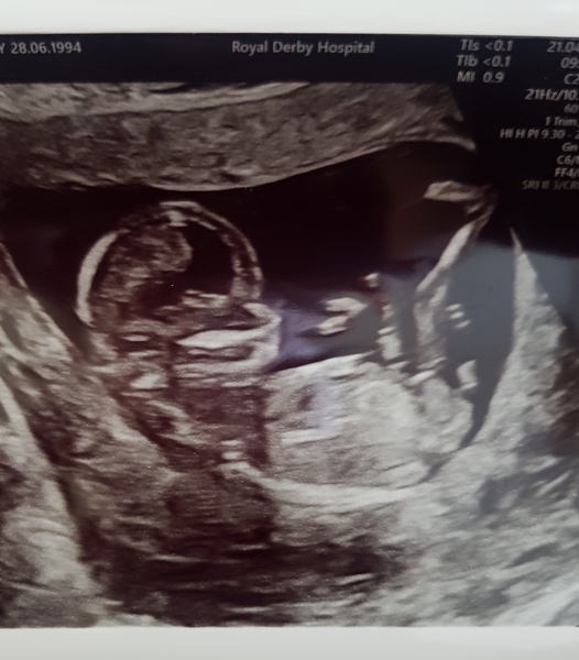 *just for fun* boy or girl?
