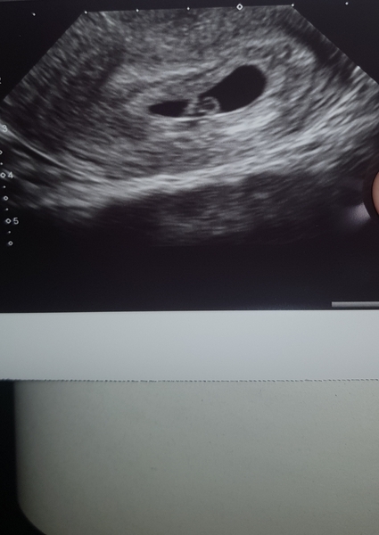 December 2020 babies thread #2
