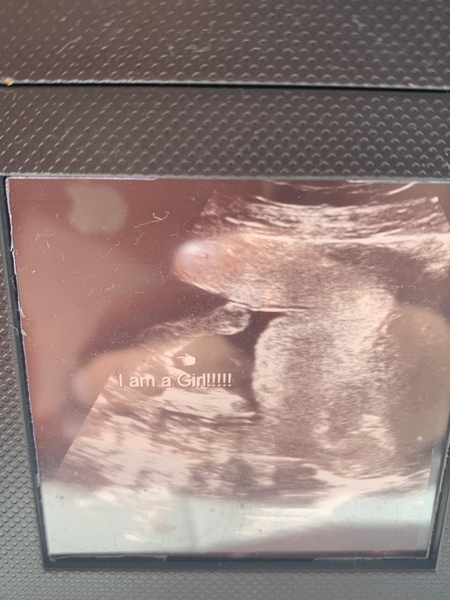 Definitely a girl??