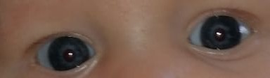Baby 16 weeks (4 months in 8 days) and still cross eyed?