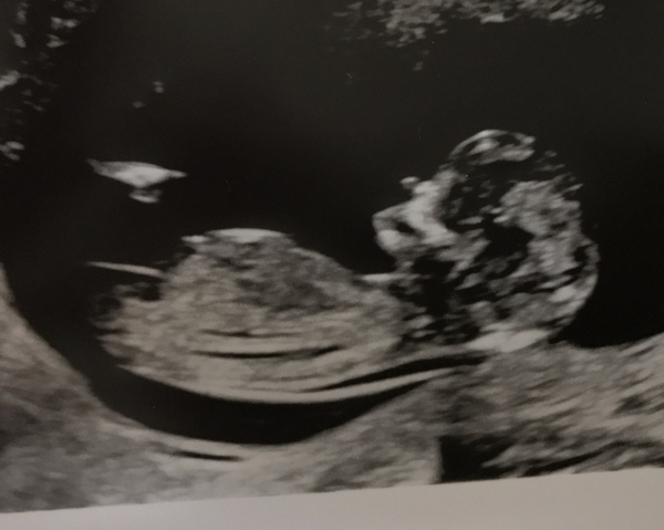 Boy or girl?