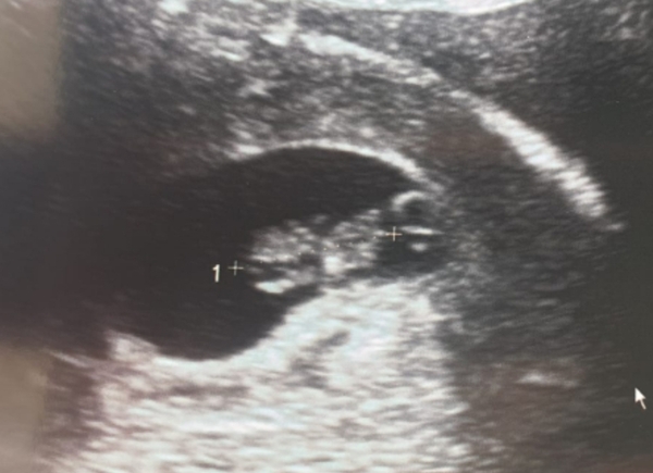 Help/advice