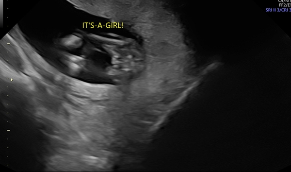 Definitely a girl??