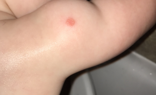 Does anyone know what this is on my baby?