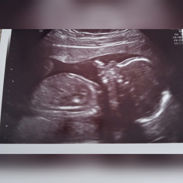 Pregnant after loss and dreaming of rainbows - 2