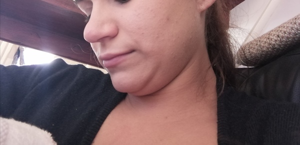 Anyone else gone from slim to fat very quickly?