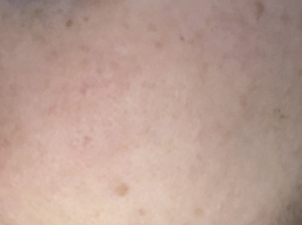 🐌 Fantastic Skincare: Is Everyone Having Botox Without Me? 💉