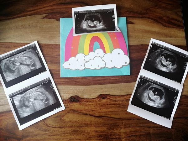 October 2020 babies