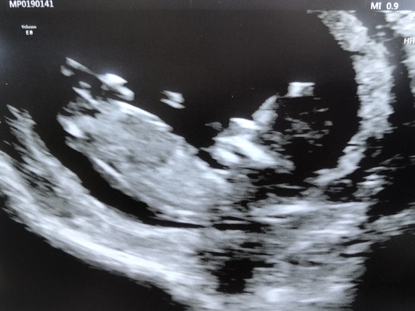 Late October babies - Thread 2