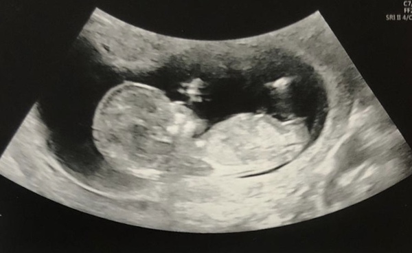 Dec19/Jan20 IVF Graduates - Thread 2