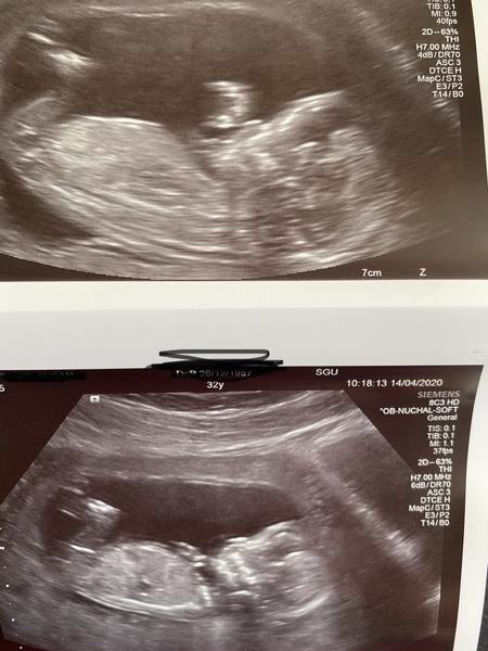 Pregnant after loss and dreaming of rainbows - 3