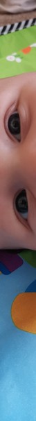 Baby 16 weeks (4 months in 8 days) and still cross eyed?