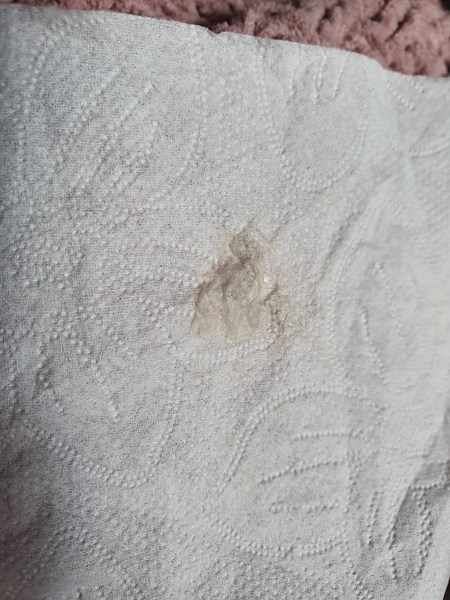 7+5 weird Discharge help!!! pic included