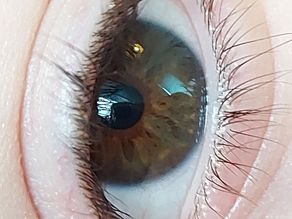 Eye colour