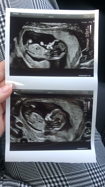 Late October babies - Thread 2