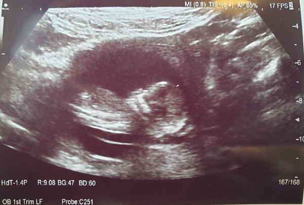 November 2020 Babies - Thread 5