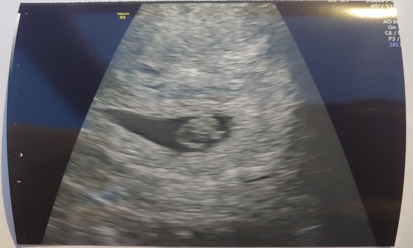 December 2020 babies