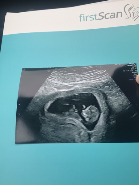 Late October babies - Thread 2