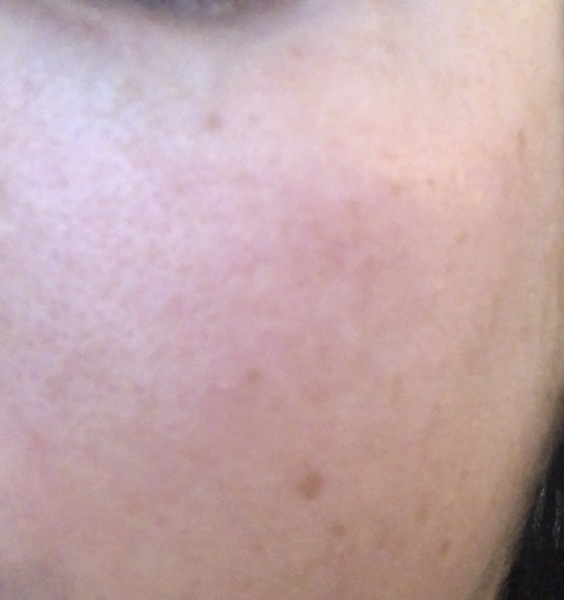 How to even out this skin tone?