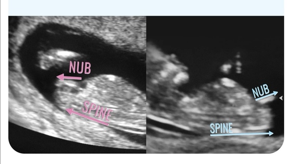 Late October babies - Thread 2