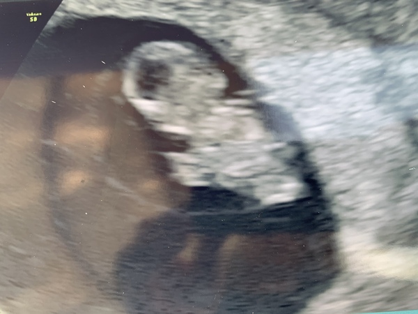 Due around 25th November 2020