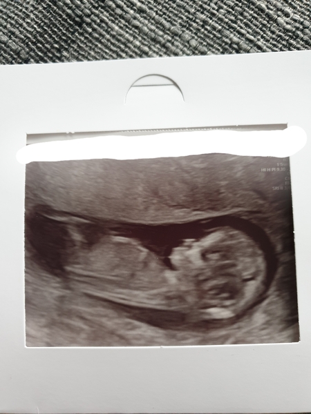 Gender reveal and guesses