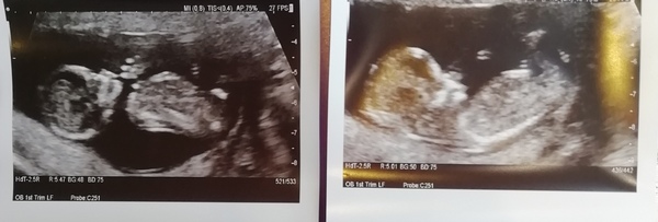 Another one, boy or girl?