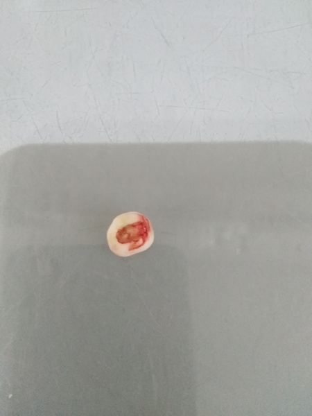 Ds just lost an adult tooth *help*