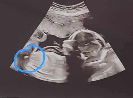 I'm a sonographer/radiographer- ask me anything.