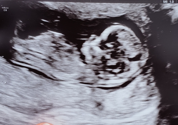 Late October babies - Thread 2