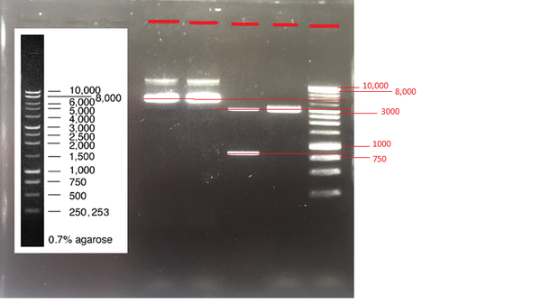Can someone help me interpret my electrophoresis results?