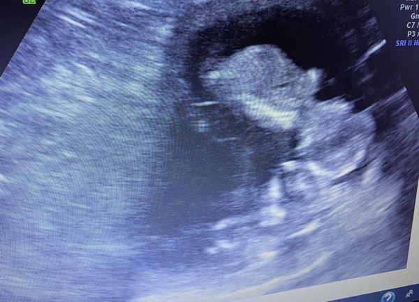 Late October babies - Thread 2