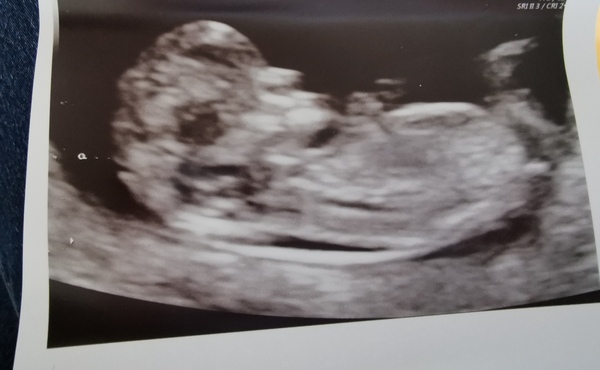 November 2020 Babies - Thread 5