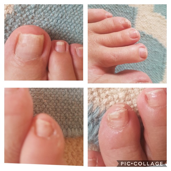 Top toe tips? Please help my manky toosties.