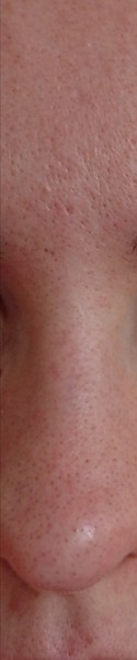 My skin is full of blackheads. Constantly.