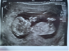 Scan pic, theories needed, BOY or Girl!? :)