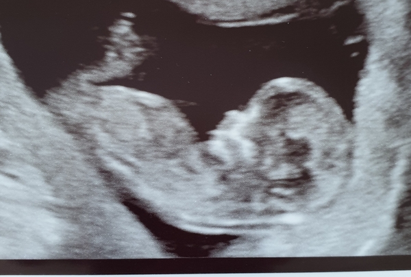 Early Oct babies part 3!
