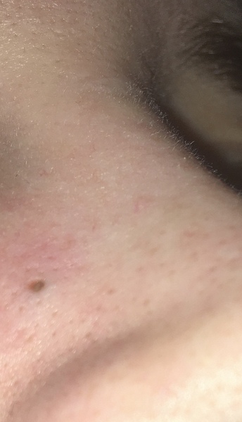 What is this monstrosity on my nose?