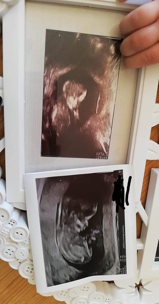 Late October babies - Thread 2