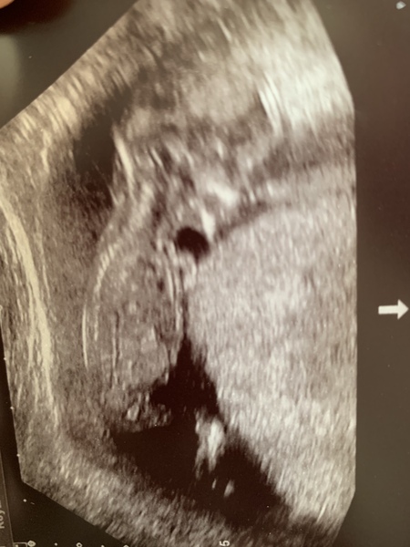 Girl or boy guesses